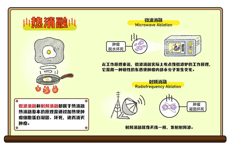 肺結節的消融治療